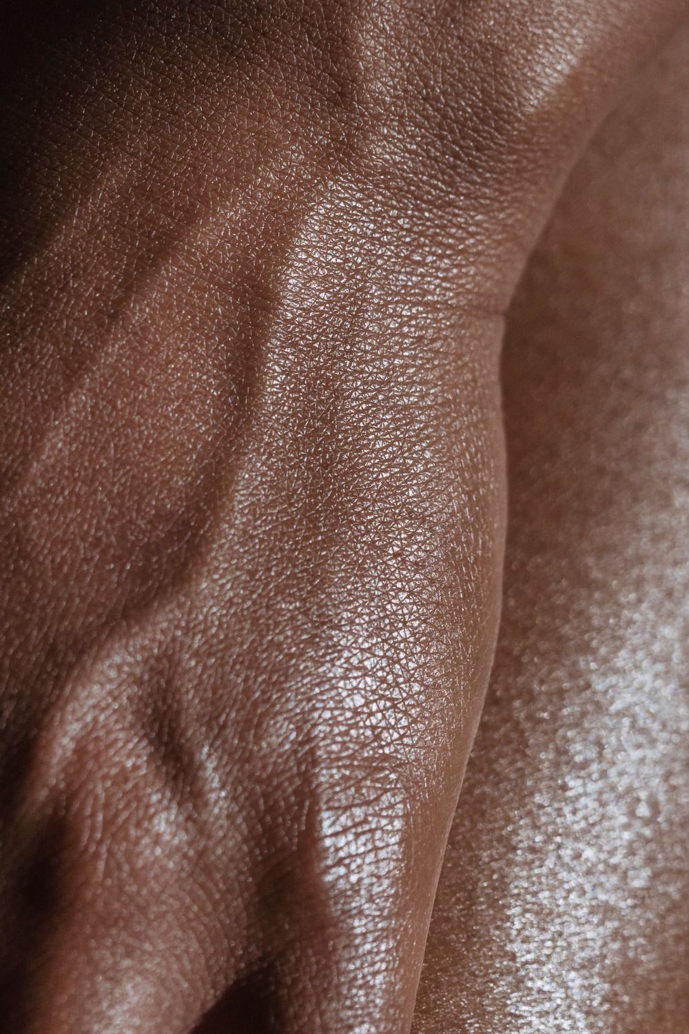 Close-up of textured brown skin surface.