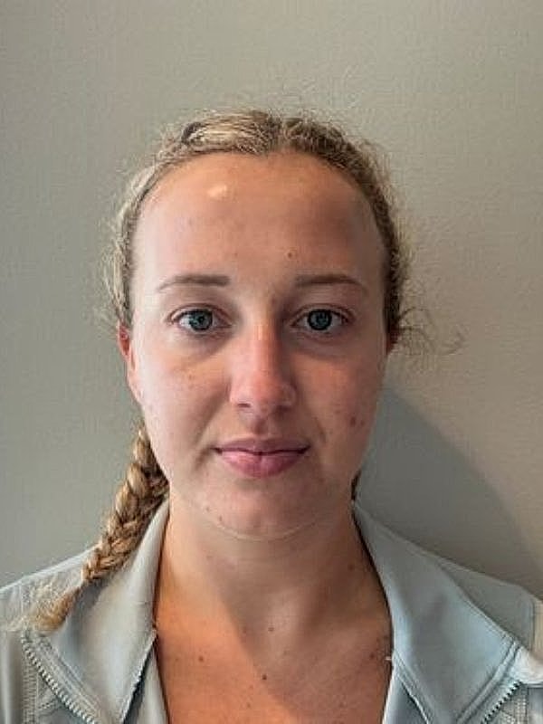 Botox Before & After