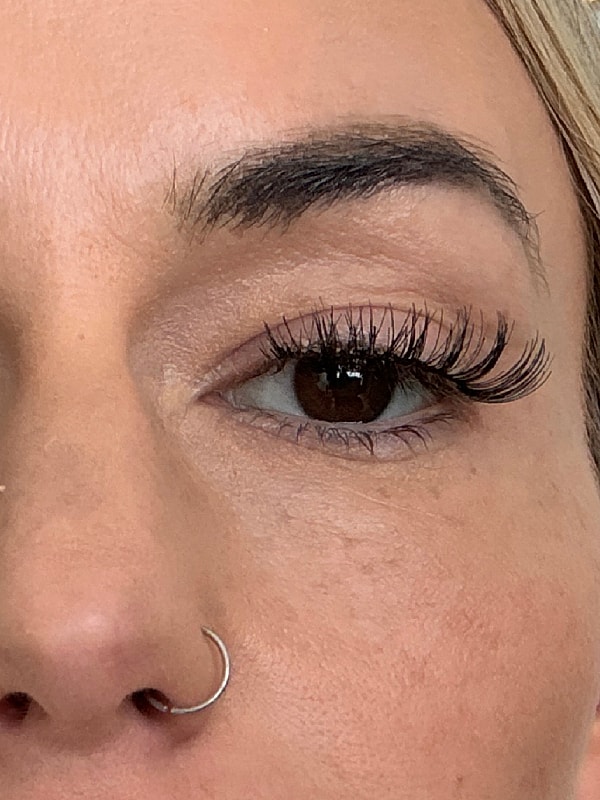 Under Eye Treatment Before & After