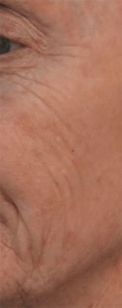 BBL Heroic Before & After